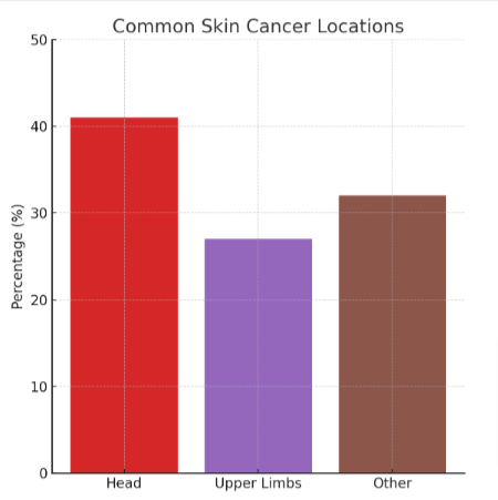 Skin cancer locations